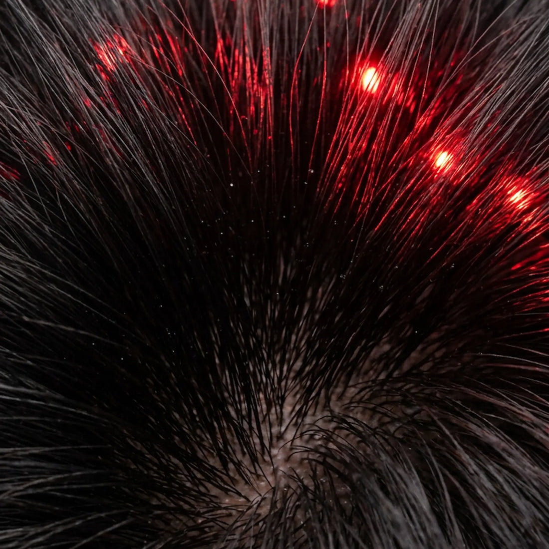 Ren lights not reaching the scalp only touching hair