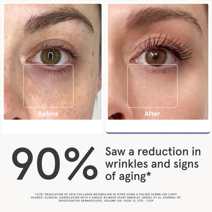 iRestore Illumina Eye Mask