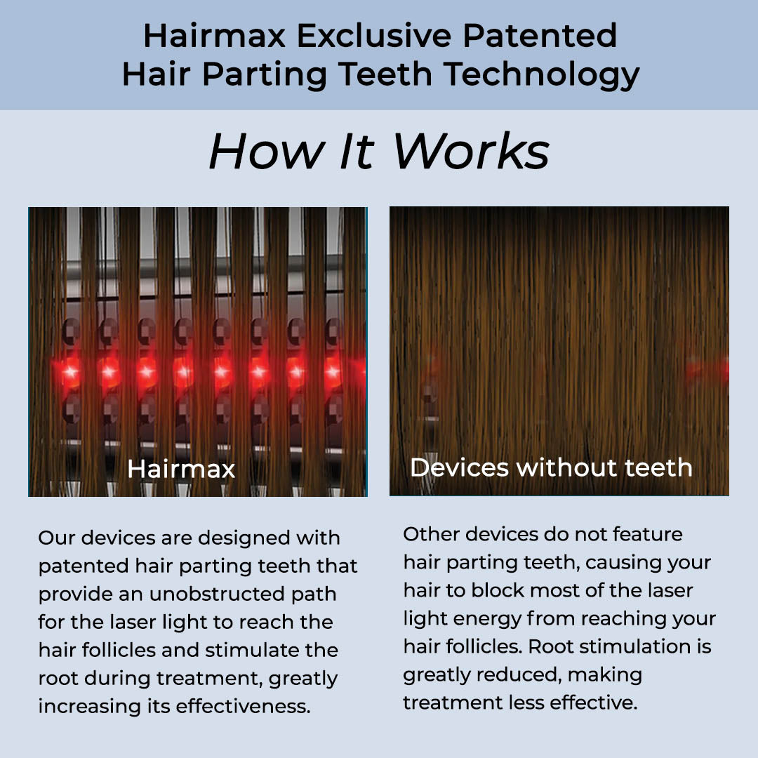 Hairmax LaserBand 82 ComfortFlex
