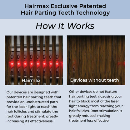 Hairmax LaserBand 82 ComfortFlex