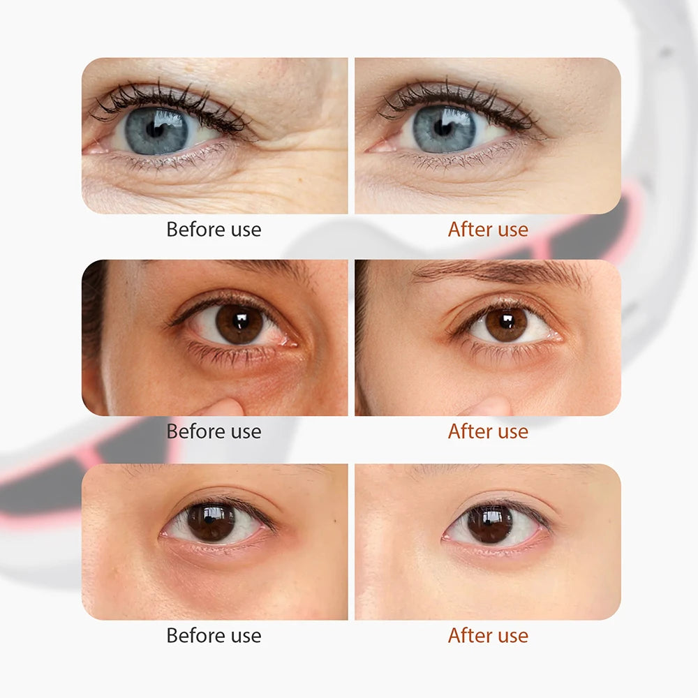 AuraZen Eye Care Rejuvenator