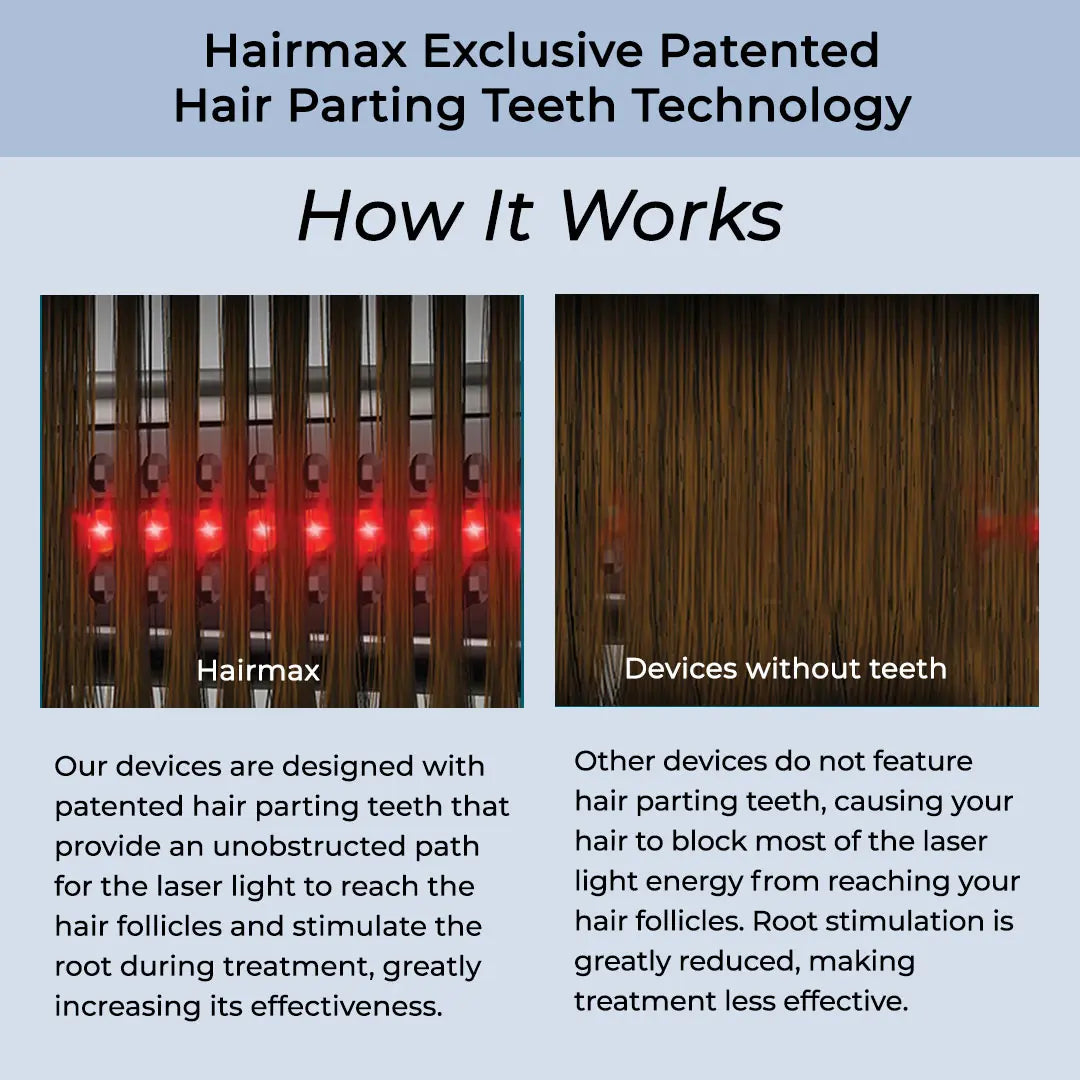 Hairmax Ultima 12 LaserComb