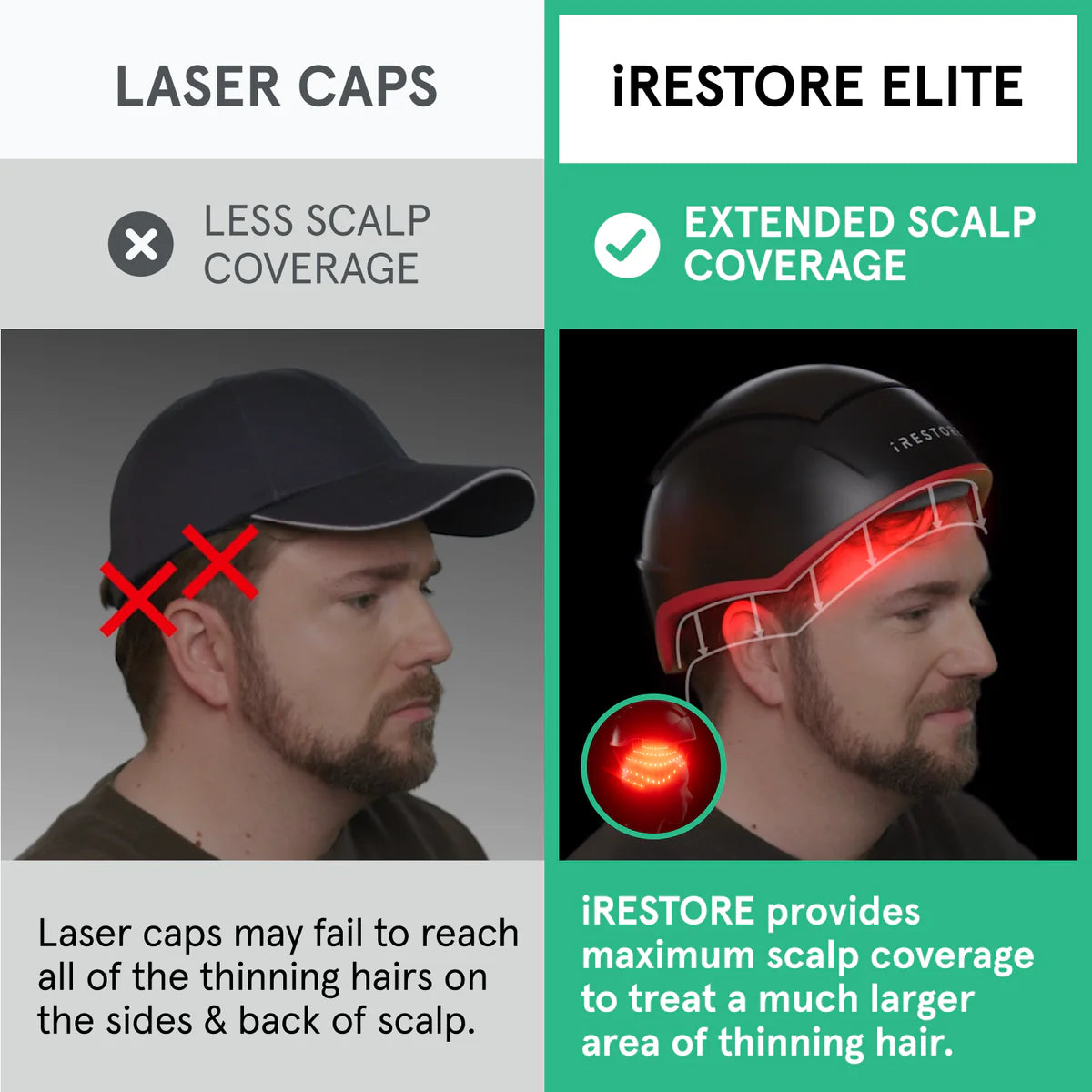 iRESTORE Elite Laser Hair Growth System