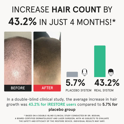 iRESTORE Elite Laser Hair Growth System