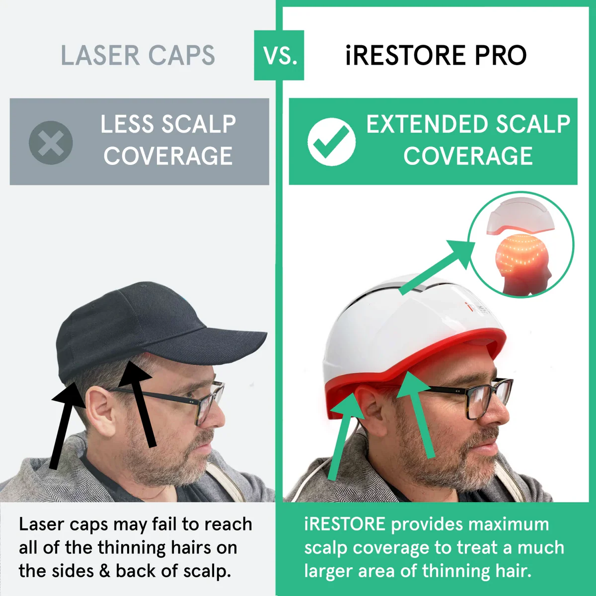 iRESTORE Professional Laser Hair Growth System