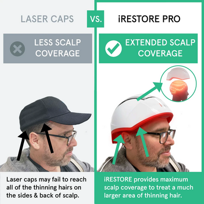 iRESTORE Essential Laser Hair Growth System