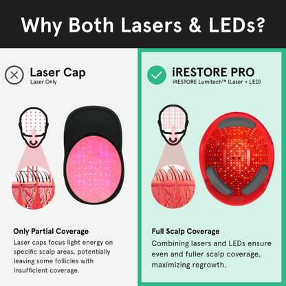 iRESTORE Professional Laser Hair Growth System