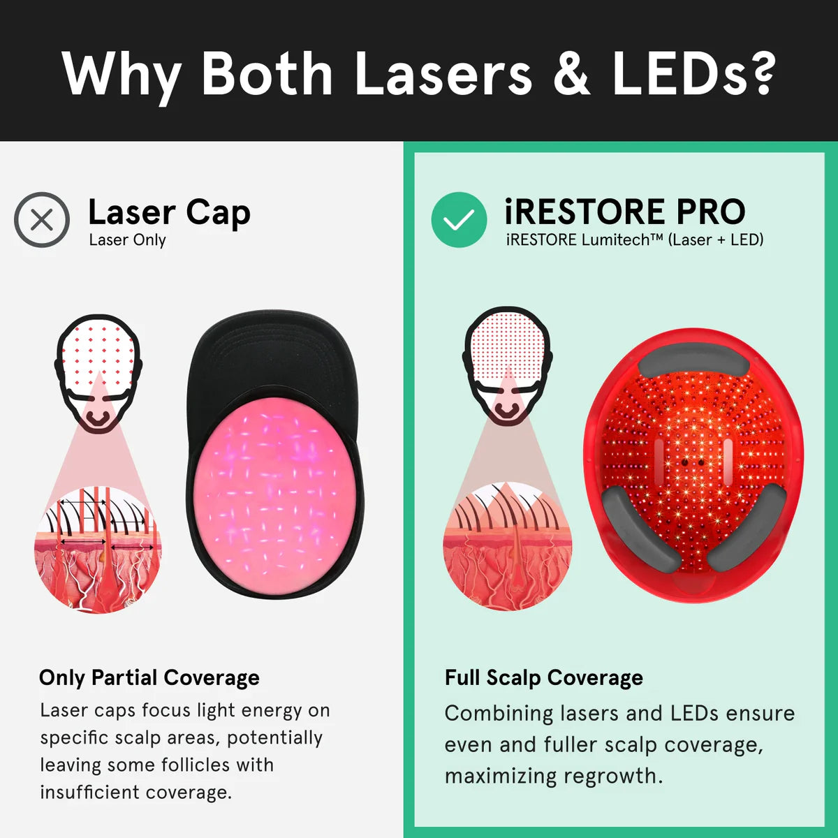 iRESTORE Essential Laser Hair Growth System