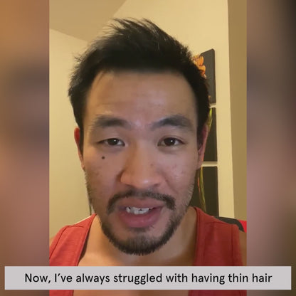 iRESTORE Essential Laser Hair Growth System